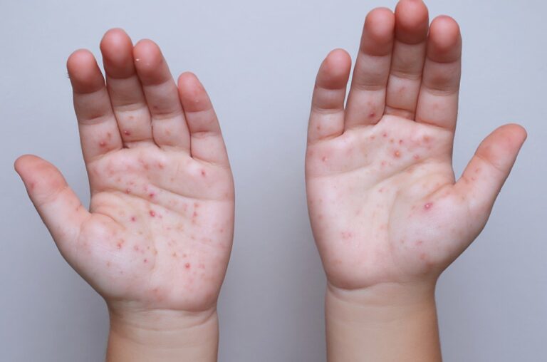 WhatsApp Image 2026-04-08 at 11.49.57 AM